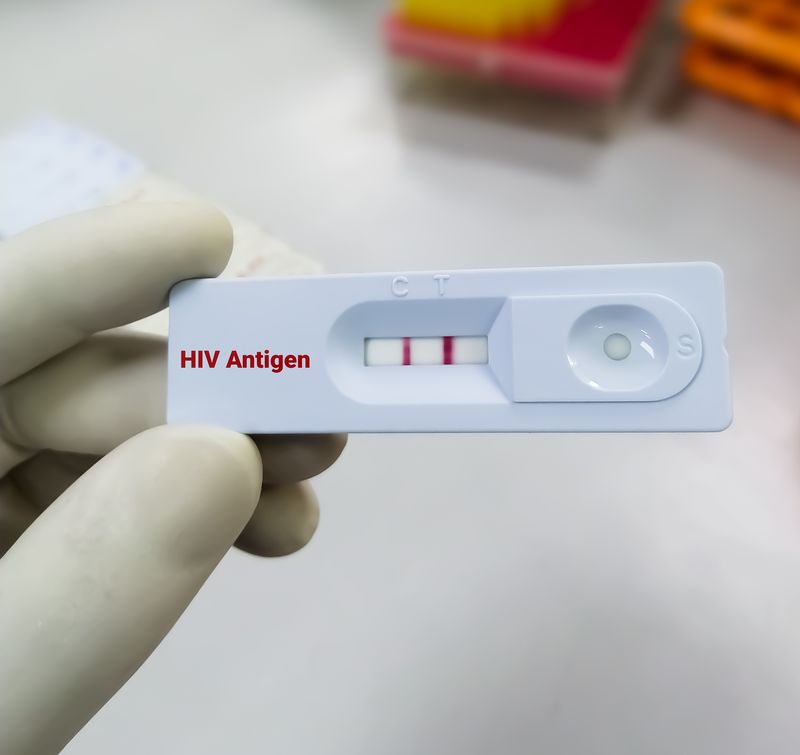 How accurate are HIV test results?
