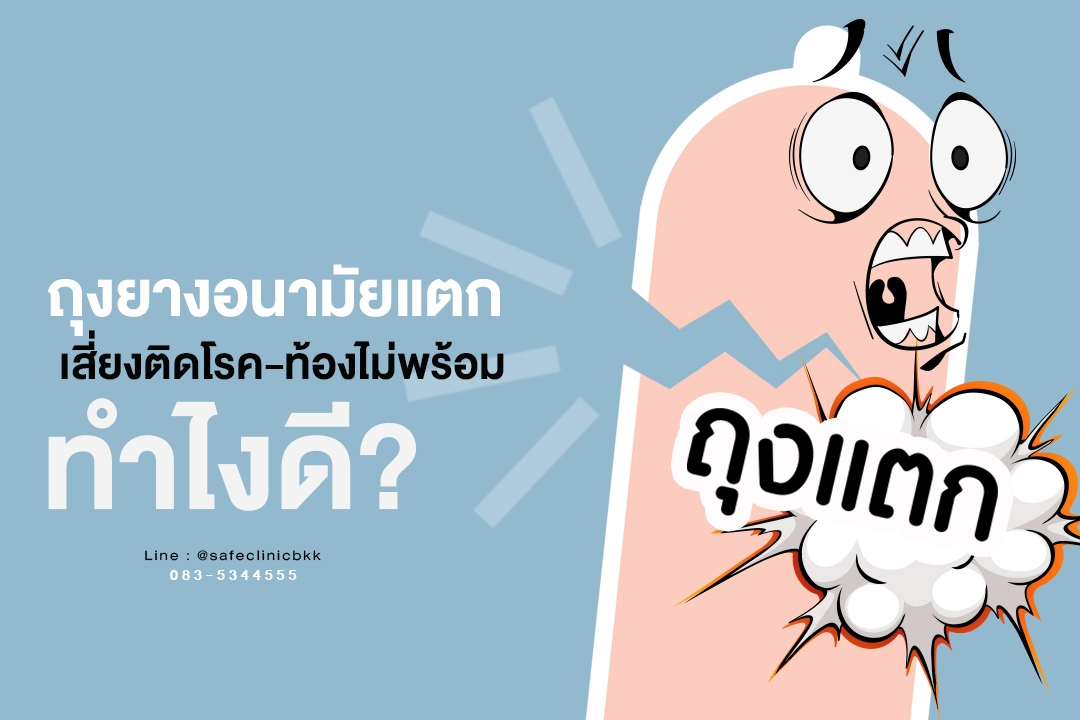 ถุงยางแตก