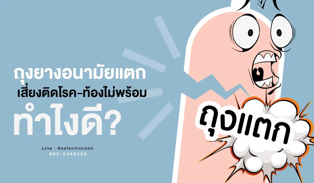 ถุงยางแตก